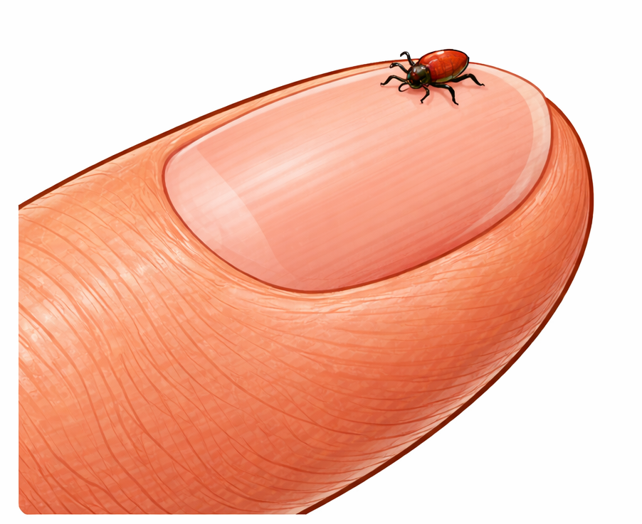 Teek herkennen en verwijderen